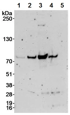 Western blot - Anti-ZBTB7A antibody (AB70208)