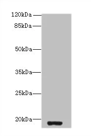 Western blot - Anti-ZBTB8OS antibody (AB237490)
