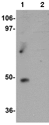 Western blot - Anti-ZBTB9 antibody (AB106628), expandable thumbnail