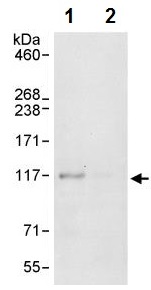 Immunoprecipitation - Anti-ZC3H11A antibody (AB241595), expandable thumbnail