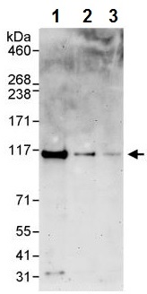 Western blot - Anti-ZC3H11A antibody (AB241595), expandable thumbnail