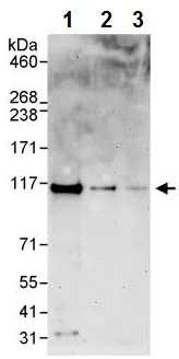Western blot - Anti-ZC3H11A antibody (AB241595)