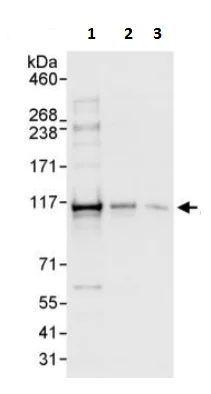 Western blot - Anti-ZC3H11A antibody (AB241612)