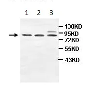 Western blot - Anti-ZC3H11A antibody (AB99930)