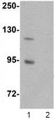 Western blot - Anti-ZC3H12B antibody (AB106710), expandable thumbnail