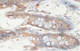 Immunohistochemistry (Formalin/PFA-fixed paraffin-embedded sections) - Anti-ZC3H12D antibody (AB100862)