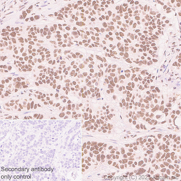Immunohistochemistry (Formalin/PFA-fixed paraffin-embedded sections) - Anti-ZC3H13 antibody [EPR25077-7] (AB314638)