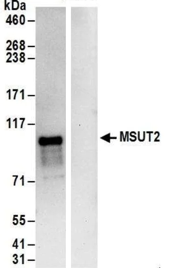 Immunoprecipitation - Anti-ZC3H14 antibody (AB169061)