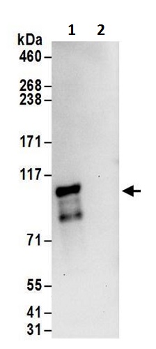Immunoprecipitation - Anti-ZC3H14 antibody (AB232936)