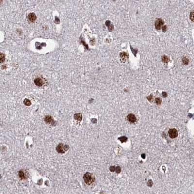Immunohistochemistry (Formalin/PFA-fixed paraffin-embedded sections) - Anti-ZC3H18 antibody (AB122673)