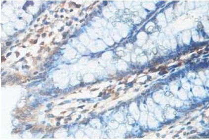 Immunohistochemistry (Formalin/PFA-fixed paraffin-embedded sections) - Anti-ZC4H2 antibody (AB100924), expandable thumbnail