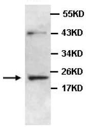 Western blot - Anti-ZC4H2 antibody (AB100924)