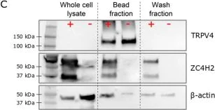 Western blot - Anti-ZC4H2 antibody (AB100924)