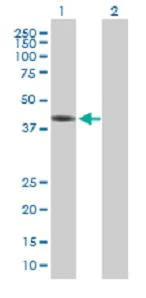 Western blot - Anti-ZCCHC2 antibody (AB88756)