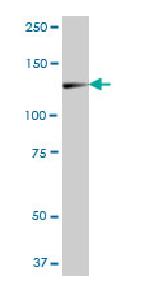 Western blot - Anti-ZCCHC2 antibody (AB88756)
