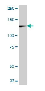 Western blot - Anti-ZCCHC2 antibody (AB88756)