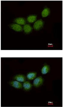 Immunocytochemistry/ Immunofluorescence - Anti-ZCCHC4 antibody (AB154002), expandable thumbnail