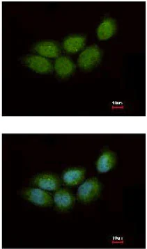 Immunocytochemistry/ Immunofluorescence - Anti-ZCCHC4 antibody (AB154002)