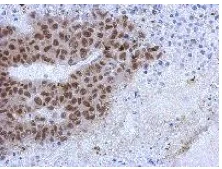 Immunohistochemistry (Formalin/PFA-fixed paraffin-embedded sections) - Anti-ZCCHC4 antibody (AB154002)