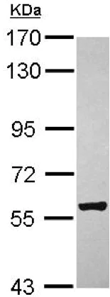Western blot - Anti-ZCCHC4 antibody (AB154002)