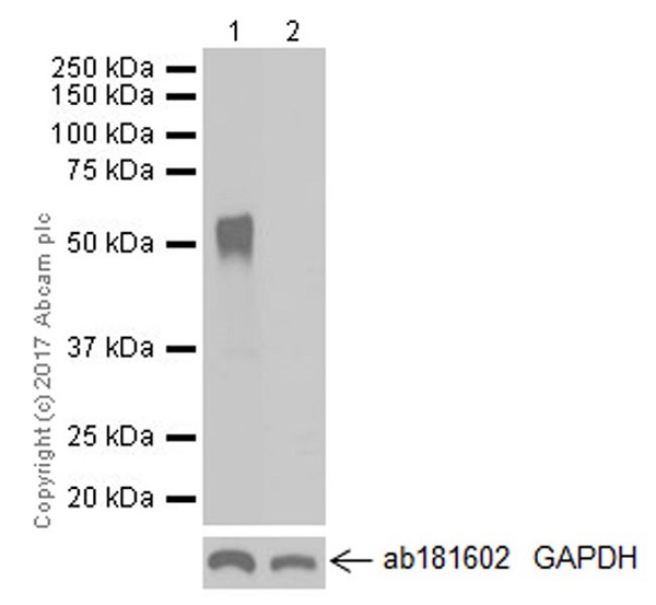 Western blot - Anti-ZCCHC4 antibody [EPR20492] (AB211325), expandable thumbnail