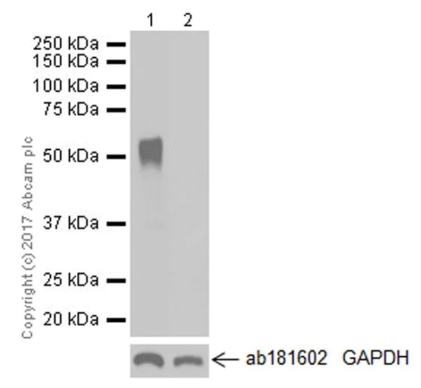 Western blot - Anti-ZCCHC4 antibody [EPR20492] (AB211325)