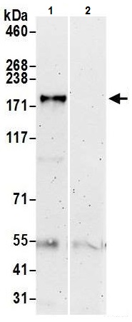 Immunoprecipitation - Anti-ZCCHC6 antibody (AB226294)