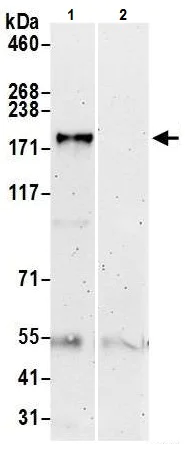 Immunoprecipitation - Anti-ZCCHC6 antibody (AB226294)