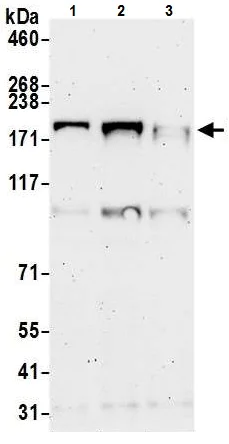 Western blot - Anti-ZCCHC6 antibody (AB226294)