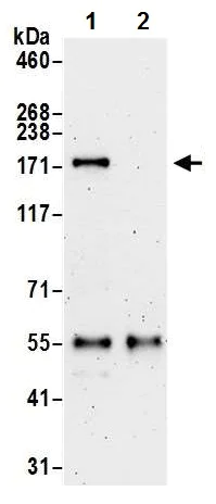 Immunoprecipitation - Anti-ZCCHC6 antibody (AB226307)