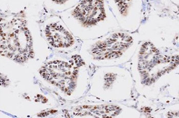 Immunohistochemistry (Formalin/PFA-fixed paraffin-embedded sections) - Anti-ZCCHC6 antibody (AB76901)
