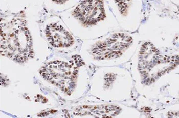 Immunohistochemistry (Formalin/PFA-fixed paraffin-embedded sections) - Anti-ZCCHC6 antibody (AB76901)