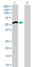 Western blot - Anti-ZCCHC6 antibody (AB76901)