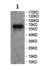 Western blot - Anti-ZCCHC7 antibody (AB104503)