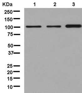 Western blot - Anti-ZCCHC8 antibody [EPR13612] (AB181152)
