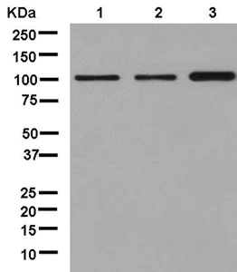 Western blot - Anti-ZCCHC8 antibody [EPR13612] - BSA and Azide free (AB250380)