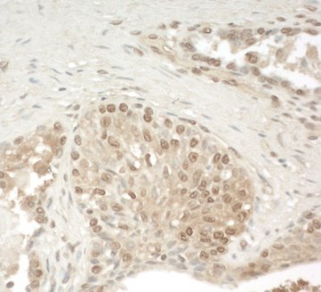 Immunohistochemistry (Formalin/PFA-fixed paraffin-embedded sections) - Anti-ZCH11 antibody (AB128180), expandable thumbnail
