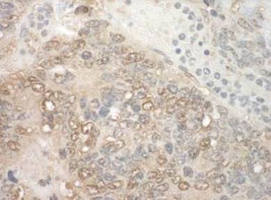 Immunohistochemistry (Formalin/PFA-fixed paraffin-embedded sections) - Anti-ZCH11 antibody (AB128180), expandable thumbnail