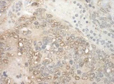 Immunohistochemistry (Formalin/PFA-fixed paraffin-embedded sections) - Anti-ZCH11 antibody (AB128180)