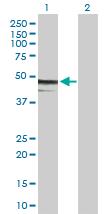 Western blot - Anti-ZCH11 antibody (AB89165), expandable thumbnail