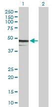 Western blot - Anti-ZCH11 antibody (AB89165)