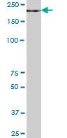 Western blot - Anti-ZCH11 antibody (AB89165), expandable thumbnail