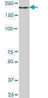 Western blot - Anti-ZCH11 antibody (AB89165)