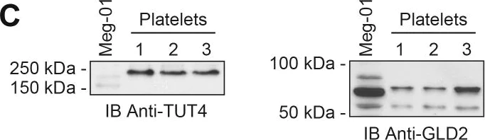 Western blot - Anti-ZCH11 antibody (AB89165)