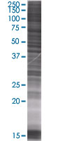 ZCH11 overexpression 293T lysate (whole cell)