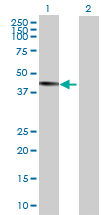 Western blot - ZCH11 overexpression 293T lysate (whole cell) (AB94144)