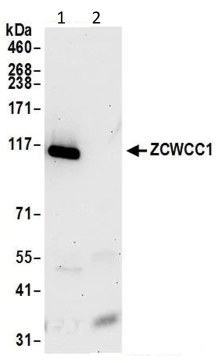 Immunoprecipitation - Anti-ZCWCC1 antibody (AB14429)