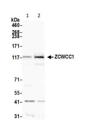 Western blot - Anti-ZCWCC1 antibody (AB14429)