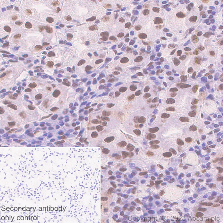 Immunohistochemistry (Formalin/PFA-fixed paraffin-embedded sections) - Anti-ZCWCC1 antibody [EPR28655-56] (AB315903)