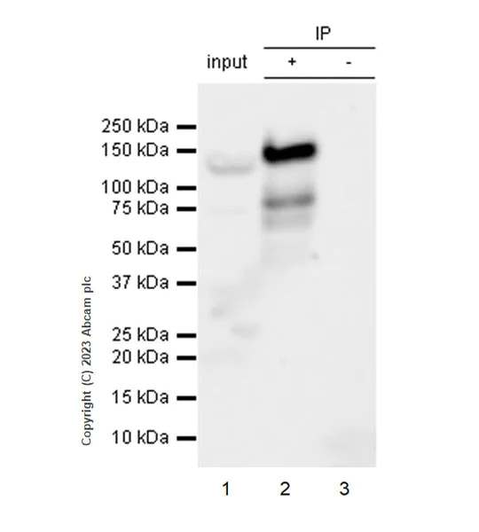 Immunoprecipitation - Anti-ZCWCC1 antibody [EPR28655-56] (AB315903)